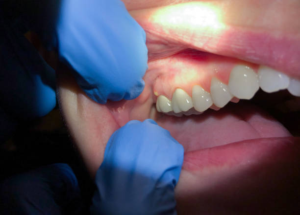 Best Walk-In Emergency Dental Services in Titusville, PA