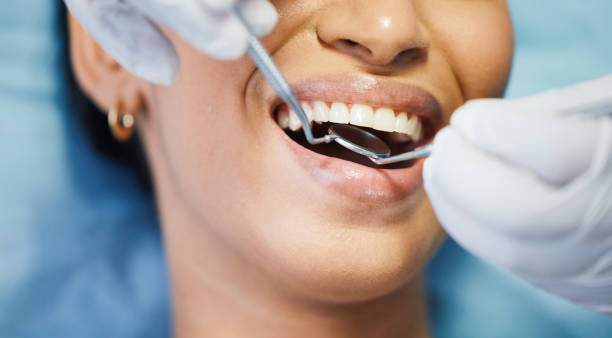 Best Emergency Wisdom Tooth Extraction in Titusville, PA